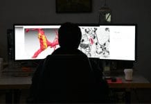 Google Publishes Biggest Ever Blue Print Of Brain – A Fly Brain