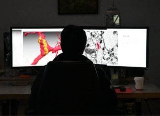 Google Publishes Biggest Ever Blue Print Of Brain – A Fly Brain