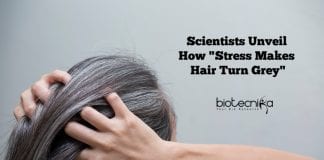 how stress makes hair turn white