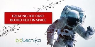 the first blood clot in space treated
