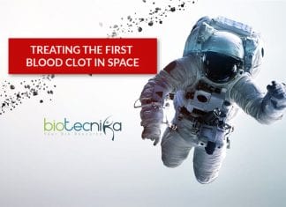 the first blood clot in space treated