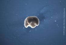 Say Hello To XENOBOTS : World’s First Living & Self-Healing Robots XENOBOTS