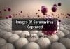 First Images Of Novel Coronavirus Captured By US Scientists microscope images of coronavirus
