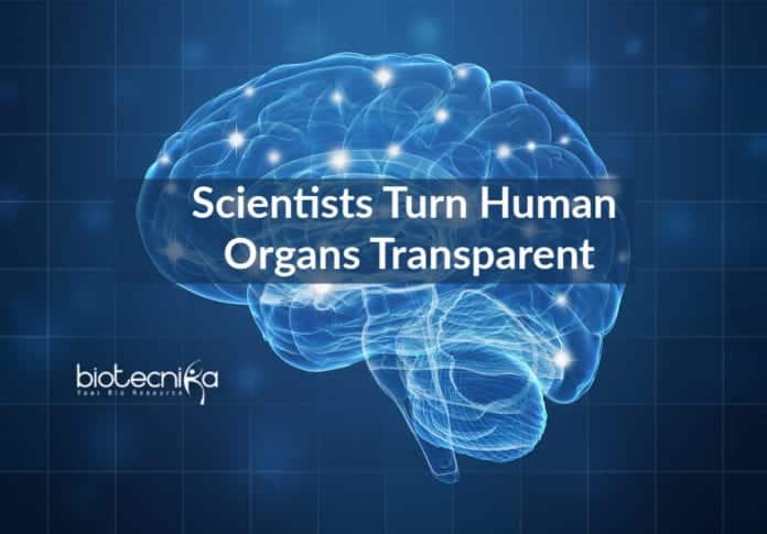 Transparent Human Organs