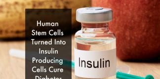 stem cells to cure diabetes