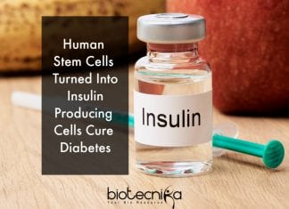 Scientists May Have Developed A Long Term Cure For Diabetes stem cells to cure diabetes