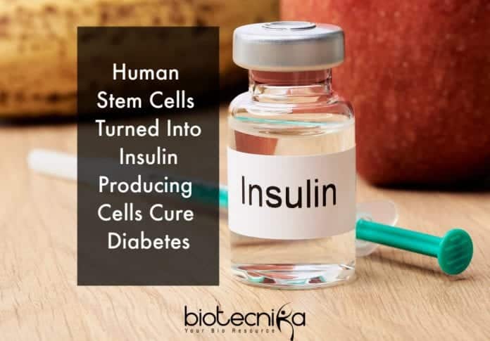 stem cells to cure diabetes