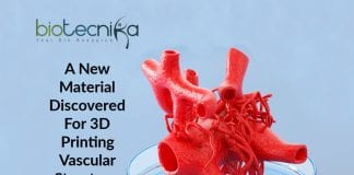 3D printing of vascular structures