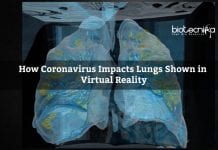 How Coronavirus Impacts Lungs Shown in Virtual Reality Lung Damage by Coronavirus shown in VR at George Washington University Hospital