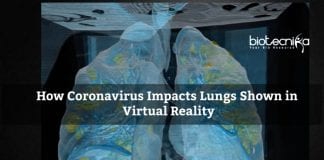 Lung Damage by Coronavirus shown in VR at George Washington University Hospital