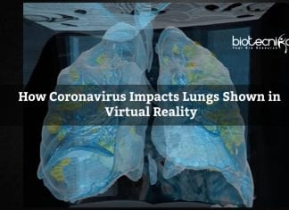 How Coronavirus Impacts Lungs Shown in Virtual Reality Lung Damage by Coronavirus shown in VR at George Washington University Hospital