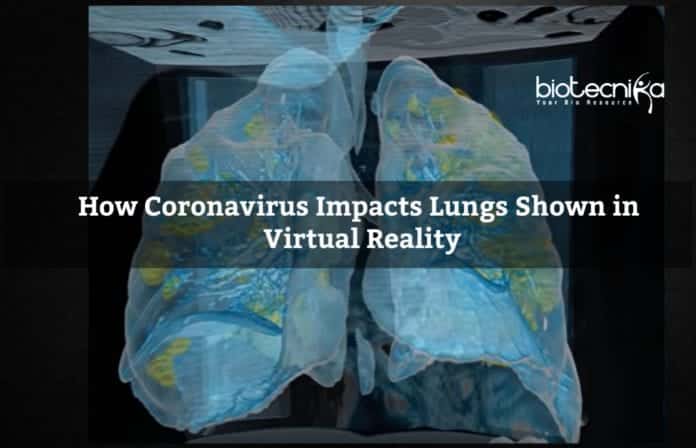 Lung Damage by Coronavirus shown in VR at George Washington University Hospital