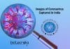 First Images Of Coronavirus In India By NIV Pune Scientists Images Of Coronavirus Captured In India