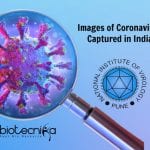 Images Of Coronavirus Captured In India