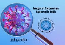 First Images Of Coronavirus In India By NIV Pune Scientists Images Of Coronavirus Captured In India