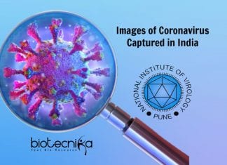 First Images Of Coronavirus In India By NIV Pune Scientists Images Of Coronavirus Captured In India