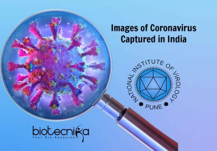 Images Of Coronavirus Captured In India