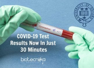 Oxford Scientists Coronavirus Test Results In Just 30 minutes! Oxford Scientists Coronavirus Test