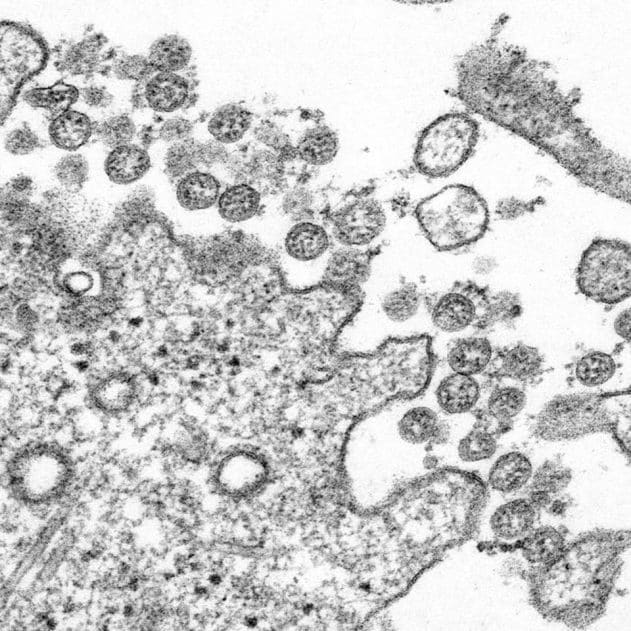 Images of Coronavirus Released by CDC