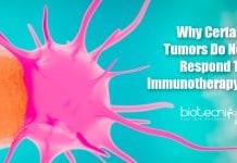 Why Certain Tumors Do Not Respond To Immunotherapy? How Tumors hide from immunotherapy