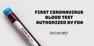 First Coronavirus Blood Test Authorized By FDA