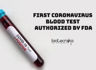 First Coronavirus Blood Test Authorized By FDA First Coronavirus Blood Test Authorized By FDA