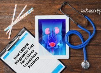New CRISPR Diagnostic Test For Kidney Transplant Patients New CRISPR Diagnostic Test Developed