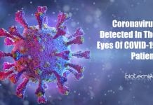 Coronavirus Detected In The Eyes Of COVID-19 Patient coronavirus found in eyes