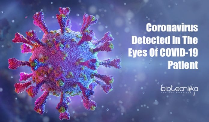 coronavirus found in eyes