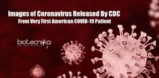 Images of Coronavirus Released by CDC