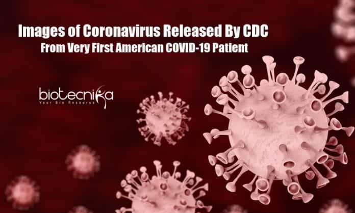 Images of Coronavirus Released by CDC