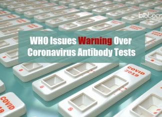 WHO Issues Warning Over Coronavirus Antibody Tests WHO Issues Warning Over Coronavirus Antibody Tests