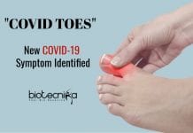 COVID Toes : News Symptom Of Coronavirus Infection Covid toes as symptom of coronavirus