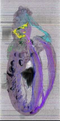 First 3D map of heart's neurons