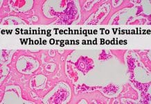 New Staining Technique To Visualize Whole Organs & Bodies New Whole-Organ/Body Staining Technique
