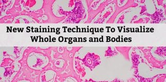 New Whole-Organ/Body Staining Technique