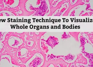 New Staining Technique To Visualize Whole Organs & Bodies New Whole-Organ/Body Staining Technique