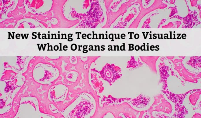 New Whole-Organ/Body Staining Technique