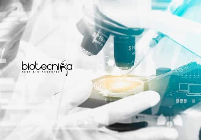 Novo Nordisk Biotechnology RA
