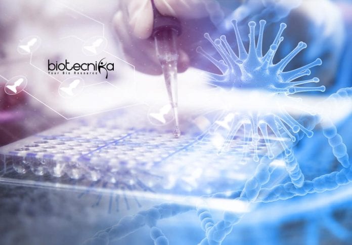 Novozymes Research Associate Vacancy