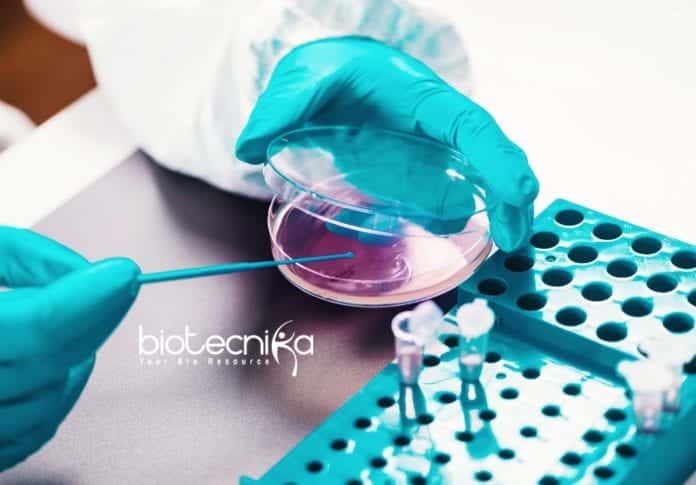 Pfizer Microbiology Investigation Lead