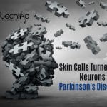 Scientists Turn Skin Cells Into Neurons To Treat Parkinson’s Disease Stem Cell Therapy For Parkinson's Disease