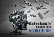 Scientists Turn Skin Cells Into Neurons To Treat Parkinson’s Disease Stem Cell Therapy For Parkinson's Disease