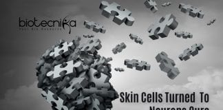 Stem Cell Therapy For Parkinson's Disease