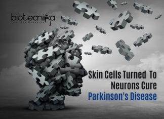 Scientists Turn Skin Cells Into Neurons To Treat Parkinson’s Disease Stem Cell Therapy For Parkinson's Disease