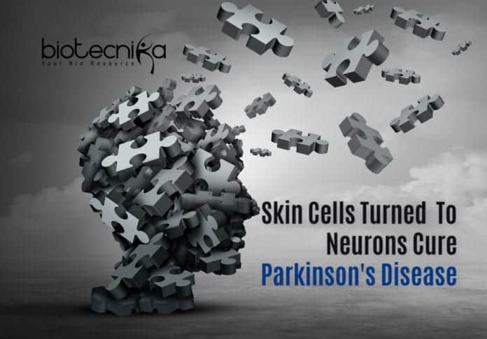 Stem Cell Therapy For Parkinson's Disease