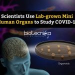 Studying COVID19 Using Organoids