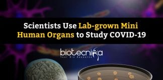 Studying COVID19 Using Organoids