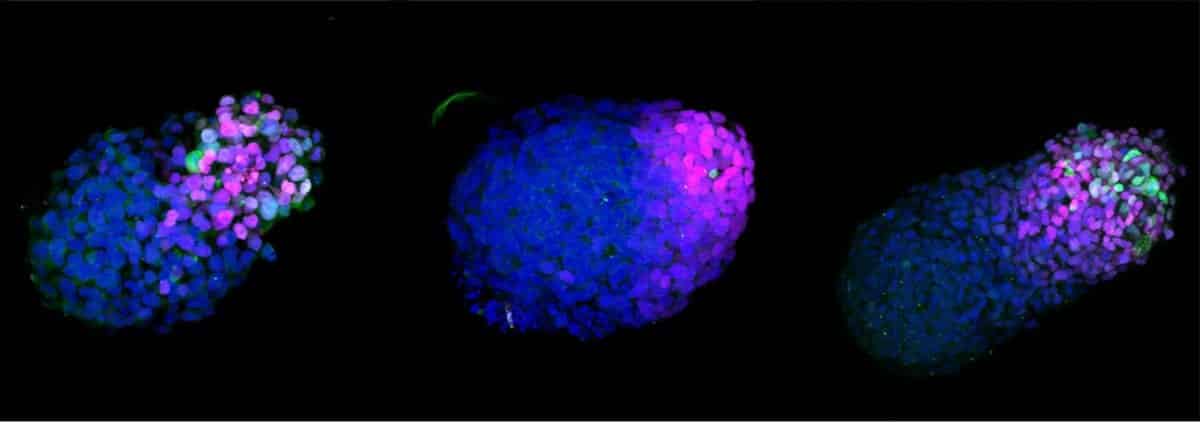 Scientists develop embryo-like model