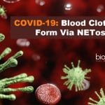 Blood Clots May Form via NETosis